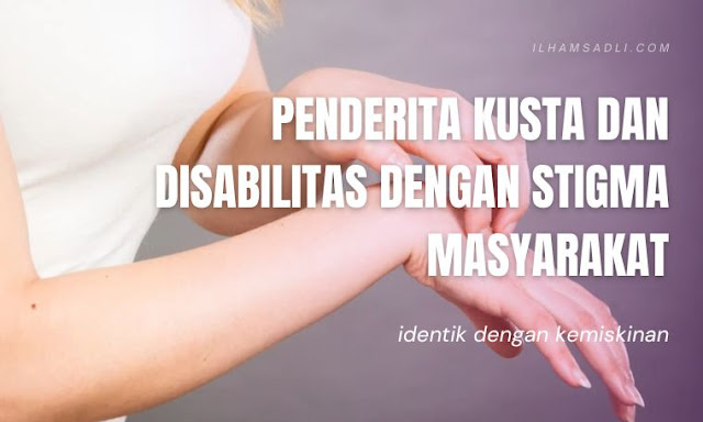 Kusta dan Disabilitas Identik dengan kemiskinan Kusta dan Disabilitas Identik dengan kemiskinan